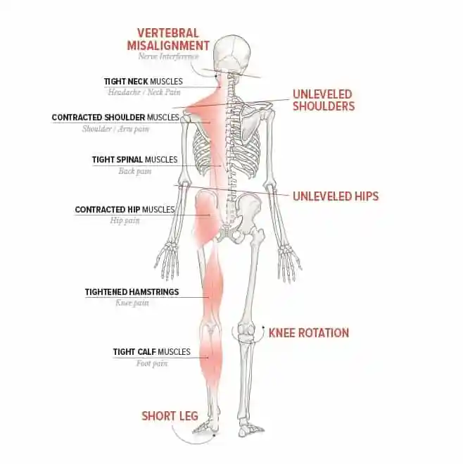 kirografiks postural imbalance cropped